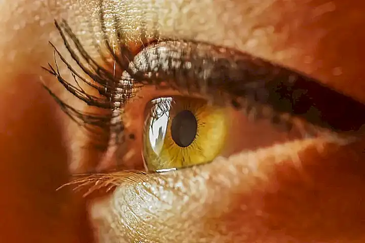 Problemas de visión que afectan a un ojo o ambos.